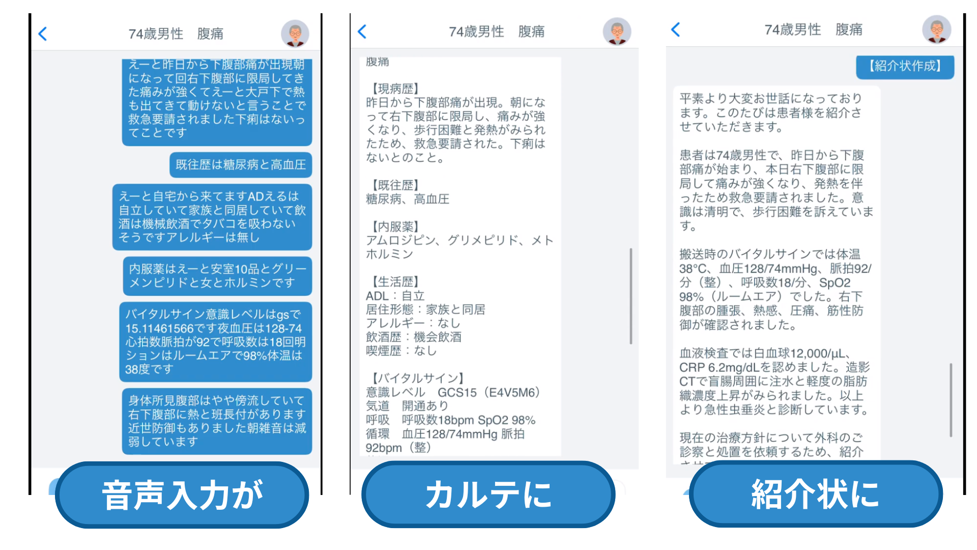 記録漏れのリスクをなくす